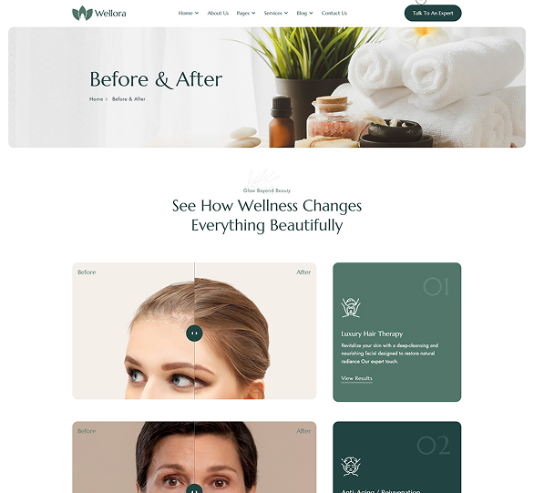 After & Before
